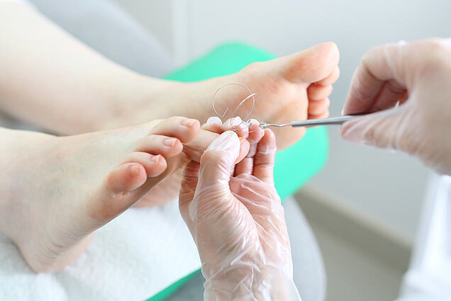 Spangentherapie Spangentherapie
